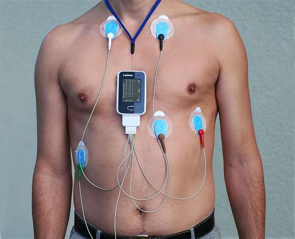 Holter 24 horas preco exame